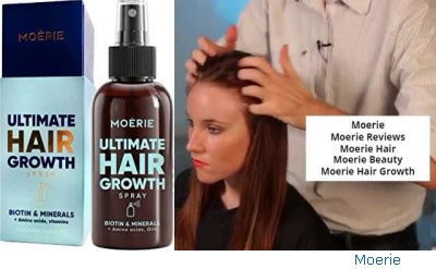 Moerie Reviews For Hair Loss